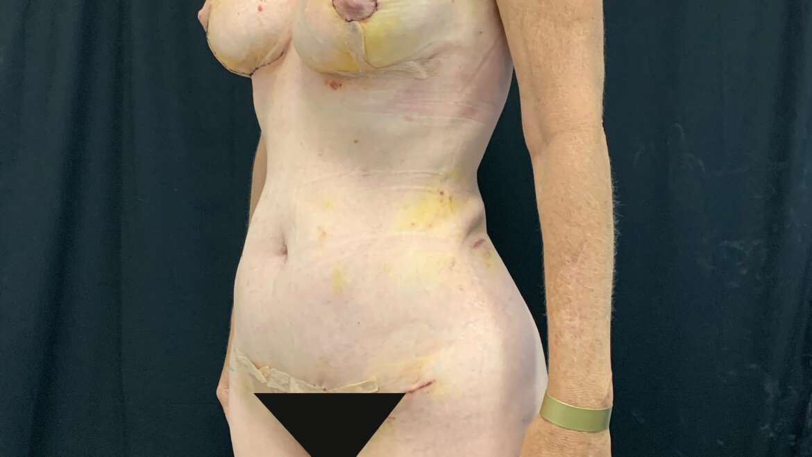 Body